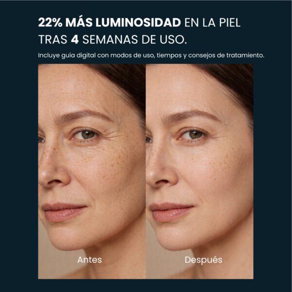 MÁSCARA DE LUZ ROJA - REDINN MASK